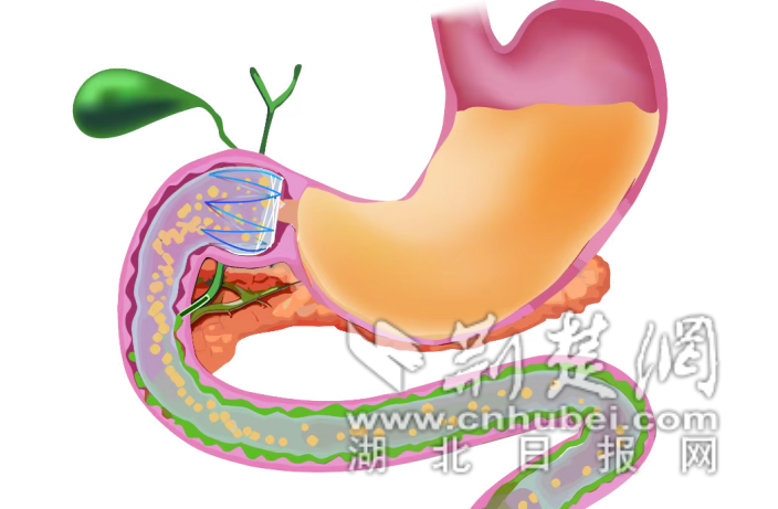 wechat_2025-08-21_164441_209_副本.png.png